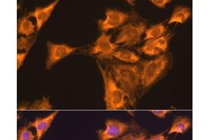 Immunofluorescence analysis of C6 cells using RPL23 Polyclonal Antibody at dilution of 1:100.