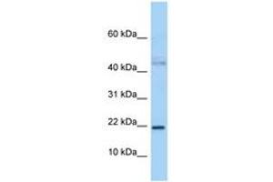 Image no. 1 for anti-Jun Dimerization Protein 2 (JDP2) (N-Term) antibody (ABIN6747974) (JDP2 anticorps  (N-Term))
