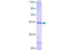 Image no. 1 for Ankyrin Repeat and SOCS Box Containing 6 (ASB6) (AA 1-197) protein (GST tag) (ABIN1345815)