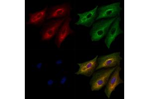 ABIN6264233 and ABIN6279658 staining  cells by IF/ICC. (PITPNA anticorps  (Internal Region))