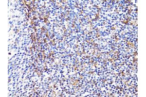 Immunohistochemistry of paraffin-embedded human tonsil using S100A10 antibody (ABIN5971035) at dilution of 1/100 (40x lens). (S100A10 anticorps)