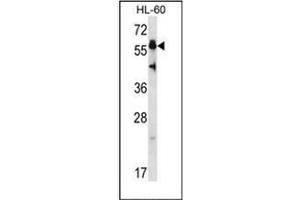 Western blot analysis of Heat shock factor 4 / HSF4 (N-term) Antibody (N-term) in HL-60 cell line lysates (35ug/lane). (HSF4 anticorps  (N-Term))