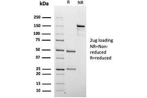 SDS-PAGE Analysis Purified Chromogranin A Mouse Recombinant Monoclonal Ab (rCHGA/798).