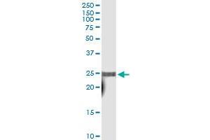 Immunoprecipitation of TAF10 transfected lysate using anti-TAF10 MaxPab rabbit polyclonal antibody and Protein A Magnetic Bead , and immunoblotted with TAF10 MaxPab mouse polyclonal antibody (B01) .
