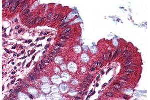 Immunohistochemistry (Formalin/PFA-fixed paraffin-embedded sections) of human colon tissue with KCNA3 polyclonal antibody . (KCNA3 anticorps  (C-Term))
