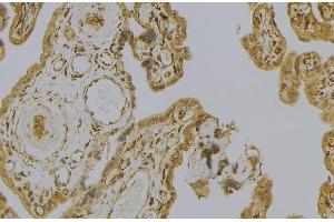ABIN6279235 at 1/100 staining Mouse placenta tissue by IHC-P. (Calpain 6 anticorps  (Internal Region))