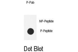 Dot blot analysis of anti-Phospho-eNos-S1177 Phospho-specific Pab on nitrocellulose membrane. (ENOS anticorps  (pSer1177))