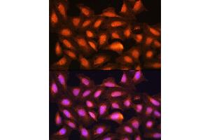 Immunofluorescence analysis of U2OS cells using MDM2 antibody (ABIN6133186, ABIN6143671, ABIN6143672 and ABIN6217278) at dilution of 1:100.