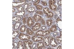 Immunohistochemical staining of human kidney with ARHGAP11A polyclonal antibody  shows moderate cytoplasmic and membranous positivity in tubular cells. (ARHGAP11A anticorps)