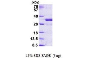SDS-PAGE (SDS) image for Fibroblast Growth Factor 14 (FGF14) (AA 1-247) protein (His tag) (ABIN5853003)