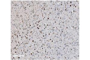 IHC analysis of EIF2B1 using anti-EIF2B1 antibody (ABIN7602821).