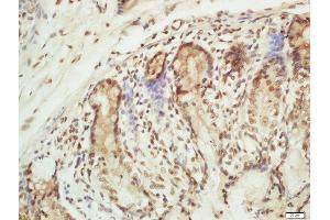 Formalin-fixed and paraffin embedded mouse intestine labeled with Rabbit Anti-RPA2(Thr21) Polyclonal Antibody, Unconjugated (ABIN713351) at 1:200 followed by conjugation to the secondary antibody and DAB staining (RPA2 anticorps  (pThr21))