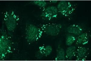 Immunocytochemistry (ICC) image for anti-Nephrosis 1, Congenital, Finnish Type (Nephrin) (NPHS1) antibody (ABIN870330) (Nephrin anticorps)
