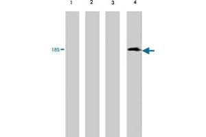 Western blot analysis of extract from red sea bream (lane 1) , carp (lane 2) , mummichog (lane 3) and medaka (lane 4) , using Vitellogenin monoclonal antibody, clone 3C1  . (Vitellogenin 2 anticorps)