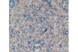 IHC-P analysis of kidney tissue, with DAB staining. (KRT12 anticorps  (AA 398-456))