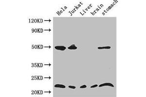 Western Blot Positive WB detected in: Hela whole cell lysate, Jurkat whole cell lysate, Mouse liver tissue, Mouse brain tissue, Mouse stomach tissue All lanes: COMMD1 antibody at 3. (COMMD1 anticorps  (AA 2-190))
