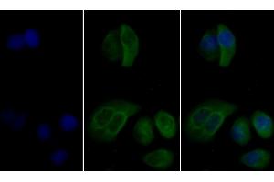 Detection of VIM in Human MCF7 Cells using Monoclonal Antibody to Vimentin (VIM)