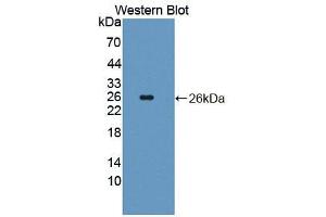 Western blot analysis of the recombinant protein. (Coronin 1a anticorps  (AA 1-204))