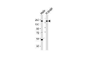 YEATS2 anticorps