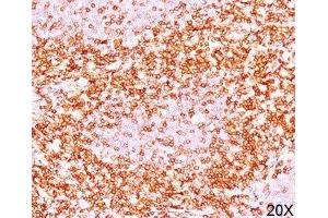 Formalin/paraffin human tonsil stained with CD6 antibody (3F7B5). (CD6 anticorps)