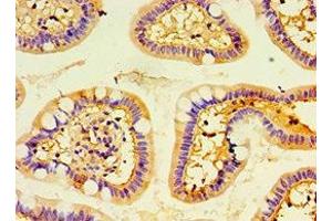 Immunohistochemistry of paraffin-embedded human small intestine tissue using ABIN7151376 at dilution of 1:100