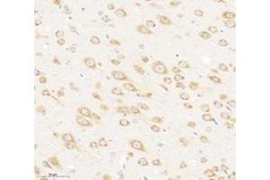 Immunohistochemistry analysis of paraffin-embedded rat brain using,VAMP4 (ABIN7076198) at dilution of 1: 3000