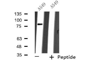 Western blot analysis of extracts from A549 cells, using ARHGEF16 antibody. (ARHGEF16 anticorps  (Internal Region))