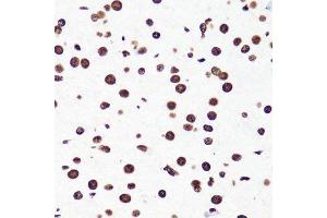 Immunohistochemistry of paraffin-embedded mouse brain using H3K36me2 antibody.