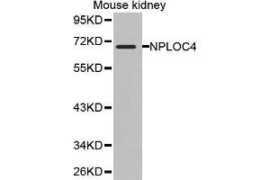 Western Blotting (WB) image for anti-Nuclear Protein Localization 4 Homolog (NPLOC4) (AA 1-270) antibody (ABIN1681086) (NPLOC4 anticorps  (AA 1-270))
