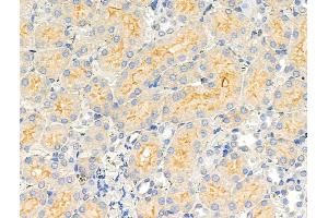 ABIN6258497 and ABIN6274436 at 1/100 staining Rat kidney tissue by IHC-P. (COQ8A anticorps  (Internal Region))