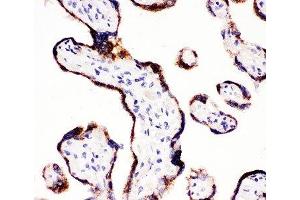 IHC-P: CYP11A1 antibody testing of human placenta tissue (CYP11A1 anticorps  (C-Term))