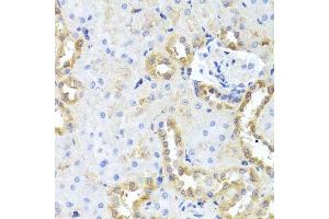 Immunohistochemistry of paraffin-embedded rat kidney using CGB7 antibody.
