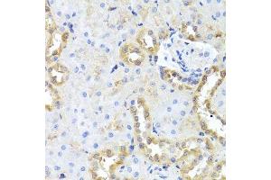 Immunohistochemistry of paraffin-embedded rat kidney using CGB7 antibody. (CGB7 anticorps  (AA 21-165))