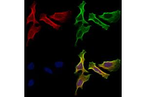 ABIN7094795 and ABIN7098846 staining Hela cells by IF/ICC. (HHIP anticorps  (C-Term))