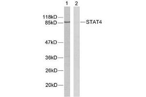 Western blot analysis of extracts from HeLa cells using STAT4 (Ab-693) antibody (E021047). (STAT4 anticorps)