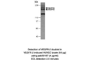 Image no. 1 for anti-VEGF Receptor 2 (VEGFR2) (AA 1200-1300), (Internal Region) antibody (ABIN363476)