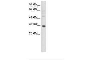 Image no. 1 for anti-Distal-Less Homeobox 5 (DLX5) (C-Term) antibody (ABIN202168) (DLX5 anticorps  (C-Term))