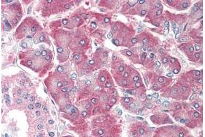 anti-AIMP1 / EMAP II (AA 137-149) antibody