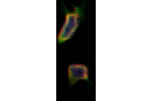ABIN6257957 and ABIN6275973 staining Hela by IF/ICC. (BAI1 anticorps  (Internal Region))