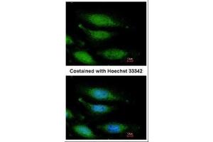 ICC/IF Image Immunofluorescence analysis of paraformaldehyde-fixed HeLa, using FANCG, antibody at 1:200 dilution.