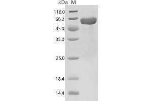 (Tris-Glycine gel) Discontinuous SDS-PAGE (reduced) with 5 % enrichment gel and 15 % separation gel.
