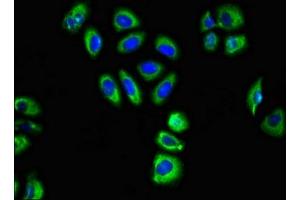 Immunofluorescent analysis of A549 cells using ABIN7153479 at dilution of 1:100 and Alexa Fluor 488-congugated AffiniPure Goat Anti-Rabbit IgG(H+L) (GABRA2 anticorps  (AA 29-251))