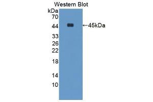 Western blot analysis of the recombinant protein. (ACAT1 anticorps  (AA 31-424))