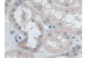 Detection of IDE in Human Kidney Tissue using Polyclonal Antibody to Insulin Degrading Enzyme (IDE)