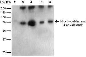 Western Blot analysis of 4-hydroxy-2-hexanal-BSA Conjugate showing detection of 67 kDa 4-hydroxy-2-hexenal-BSA using Mouse Anti-4-hydroxy-2-hexenal Monoclonal Antibody, Clone 6F10 . (4-Hydroxy-2-Hexenal (4-HHE) anticorps)