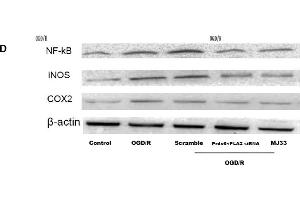 Effect of Prdx6-iPLA2 on nuclear factor-kappa B (NF-κB), inducible nitric oxide synthase (iNOS) and cyclooxygenase-2 (COX-2) expression in microglia in response to OGD/R.