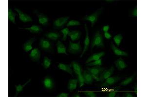 Immunofluorescence of monoclonal antibody to HOXD11 on HeLa cell.