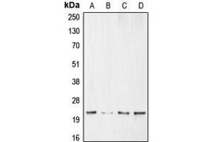 Western blot analysis of BNIP3 expression in HeLa (A), MCF7 (B), SHSY5Y (C), Ramos (D) whole cell lysates. (BNIP3 anticorps  (Center))