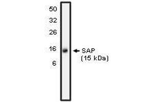 Western blot analysis using SAP antibody on NK-92 cell lysate at 10 µg/ml). (APCS anticorps)