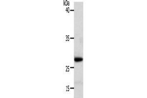 Western Blotting (WB) image for anti-Retinoic Acid Receptor Responder (Tazarotene Induced) 1 (RARRES1) antibody (ABIN2826570) (RARRES1 anticorps)
